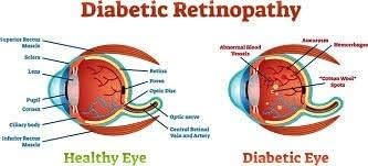 Natural Herbal Diabetic Patch